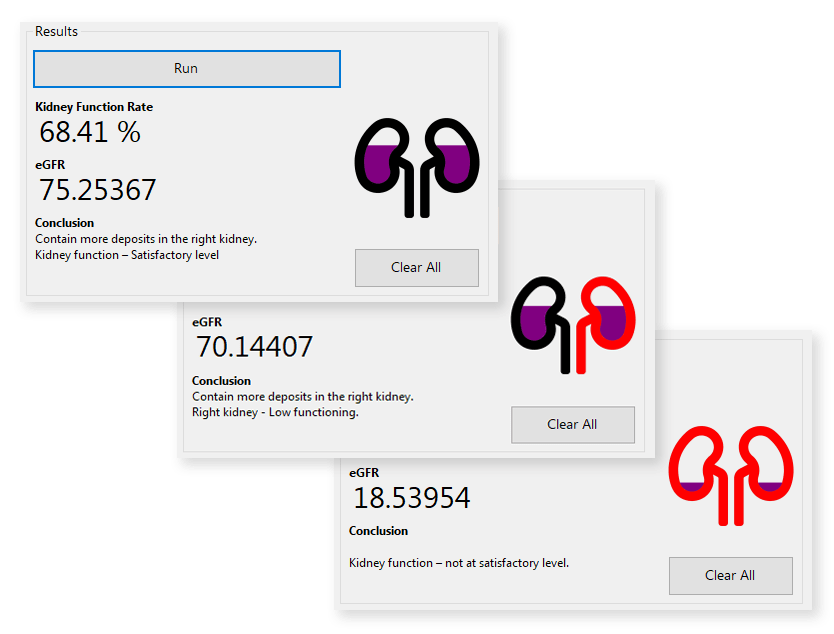 software results